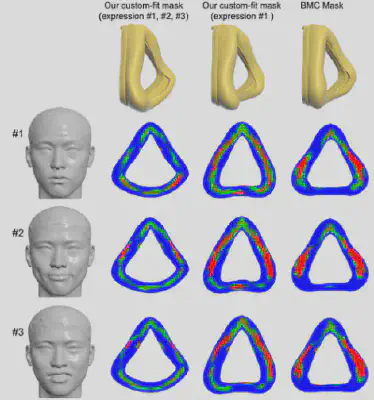 图4 该方法可以为同一个用户设计适应三种不同表情的定制化面罩（左），实现比仅为表情#1设计的定制化面罩（中）以及通用面罩（右）更好的贴合性能